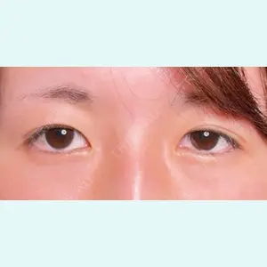 症例
