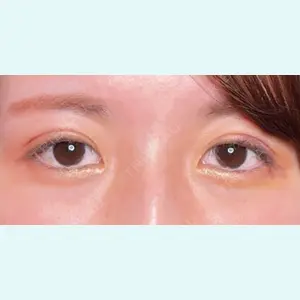 症例