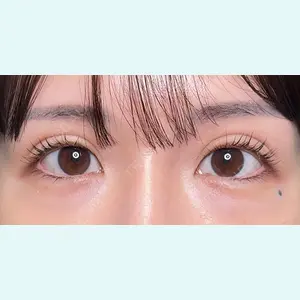 症例