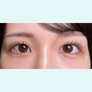 症例