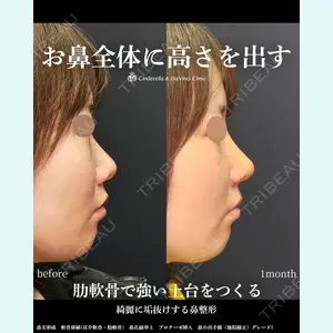 シンデレラ＆ダヴィンチクリニック 宮田 洋佑医師の症例
