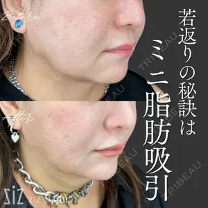 ziz CLINIC 村岡 史子医師の症例