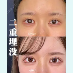症例