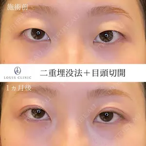 LOUIS CLINIC 二子玉川院【ルイクリニック】 小松 塁医師の症例