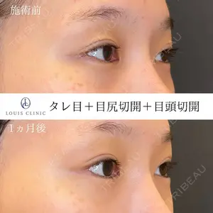 LOUIS CLINIC 二子玉川院【ルイクリニック】 小松 塁医師の症例
