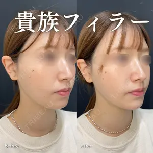 症例