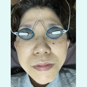 脱毛クリニック麒麟 林 陽子医師の症例