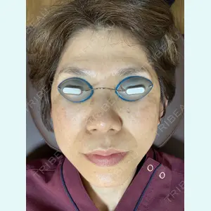 脱毛クリニック麒麟 林 陽子医師の症例