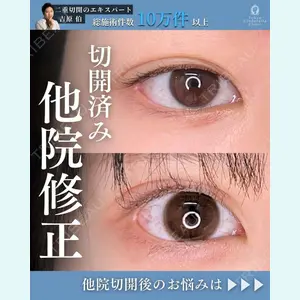 東京シンデレラ美容外科 新宿院 吉原 伯医師の症例