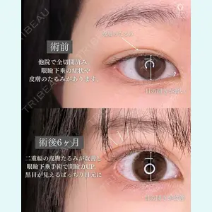 東京シンデレラ美容外科 新宿院 吉原 伯医師の症例