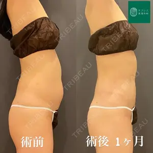 オアシス美容外科の症例