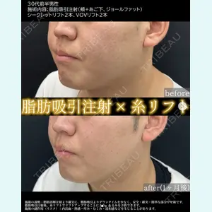 症例