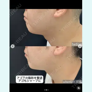 症例