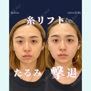 症例