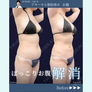 東京シンデレラ美容外科 新宿院 吉原 伯医師の症例