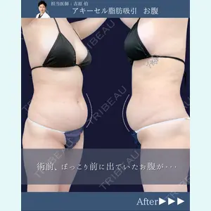 東京シンデレラ美容外科 新宿院 吉原 伯医師の症例