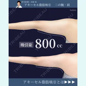 東京シンデレラ美容外科 新宿院 吉原 伯医師の症例