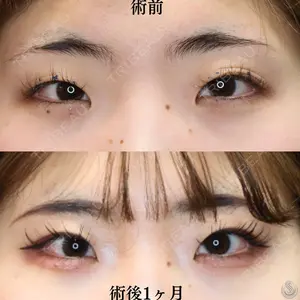 症例