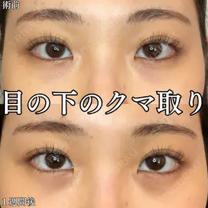 形成外科と美容外科のクリニック池袋 春日 航医師の症例