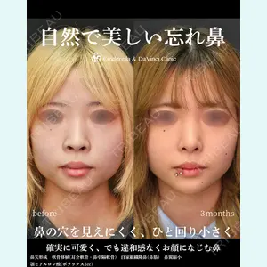 シンデレラ＆ダヴィンチクリニック 宮田 洋佑医師の症例
