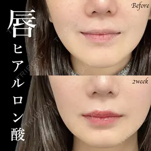 症例