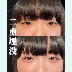 症例