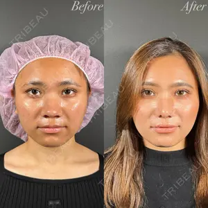 R Beauty CLINIC 名古屋院 木村 尚大医師の症例