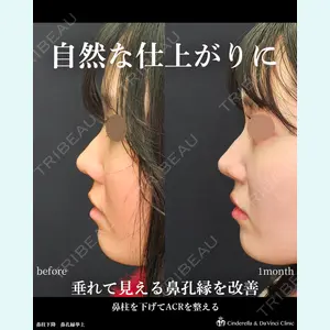 シンデレラ＆ダヴィンチクリニック 宮田 洋佑医師の症例
