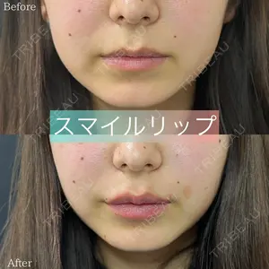 症例
