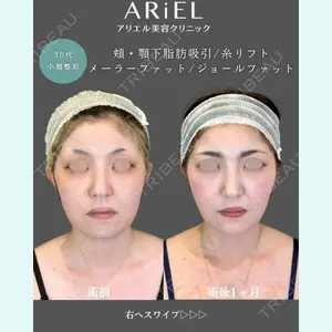アリエル美容クリニック 郡山院 安齋 誠基医師の症例