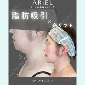 アリエル美容クリニック 郡山院 安齋 誠基医師の症例
