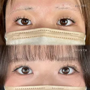 症例