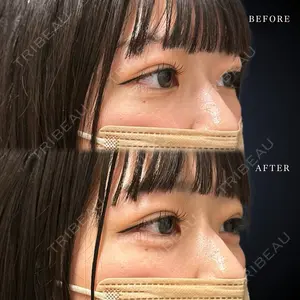 症例