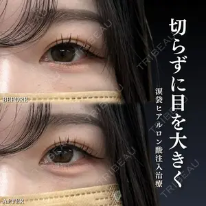 症例