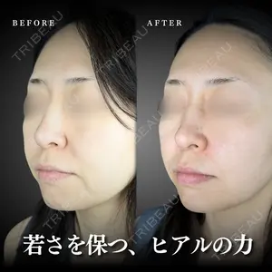 ルラ美容クリニック 千葉院の症例