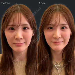 HAAB×DREAM BEAUTY CLINIC 東京本院 佐野 圭医師の症例