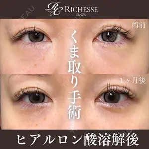 症例