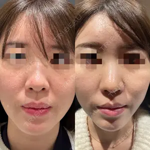 エターナル美容クリニック 久門田 詳医師の症例