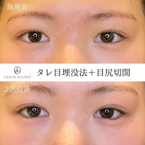 LOUIS CLINIC 二子玉川院【ルイクリニック】 小松 塁医師の症例