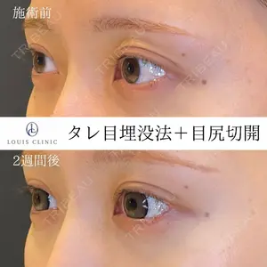 LOUIS CLINIC 二子玉川院【ルイクリニック】 小松 塁医師の症例