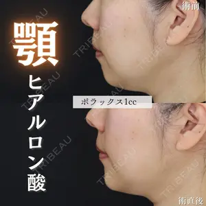症例