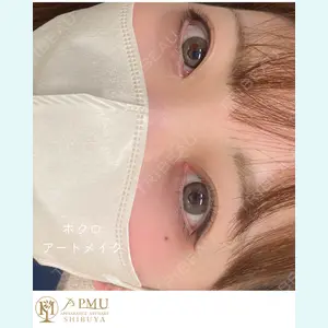 症例