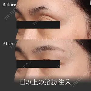 THE CLINIC（ザ・クリニック） 東京院 帯包 雄次郎医師の症例