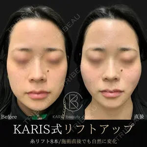 KARIS beauty clinic 滝内 ヒロフミ医師の症例