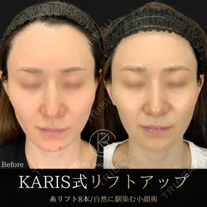 KARIS beauty clinic 滝内 ヒロフミ医師の症例