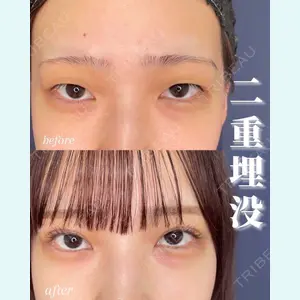 症例