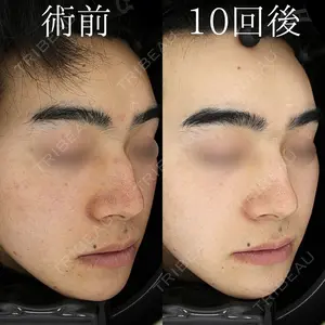 HAAB BEAUTY CLINIC 名古屋院の症例