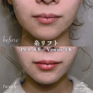 症例