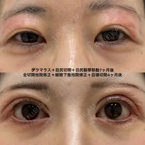 エターナル美容クリニック 久門田 詳医師の症例