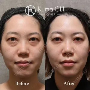 Kuma CLI 【クマクリ】 毛利 理人医師の症例